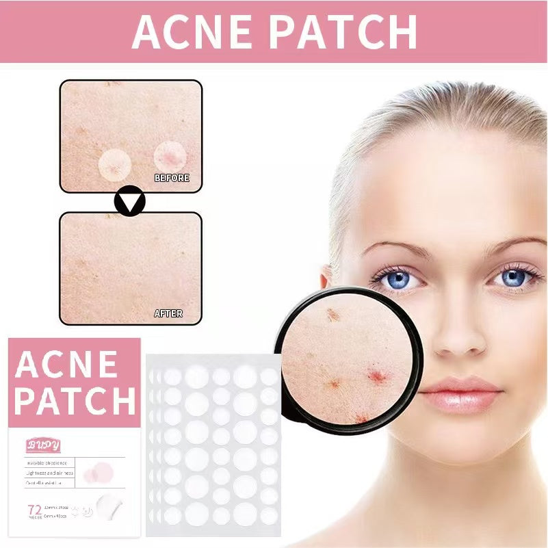 Hydrocolloid Acne Pimple Patch for Covering Zits and Blemishes, Spot Stickers for Face and Skin (144 Count)